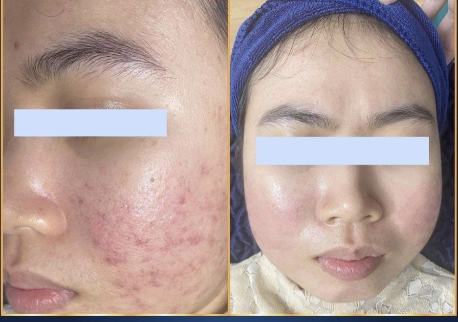 Skin Treatment in Poipet — image 8