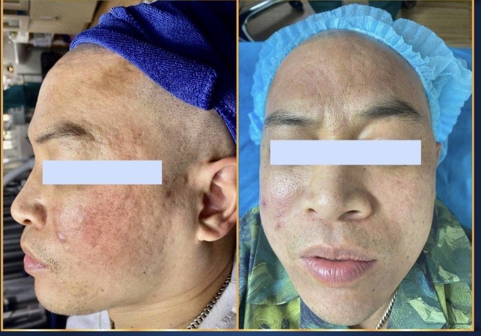 Skin Treatment Guide in Poipet