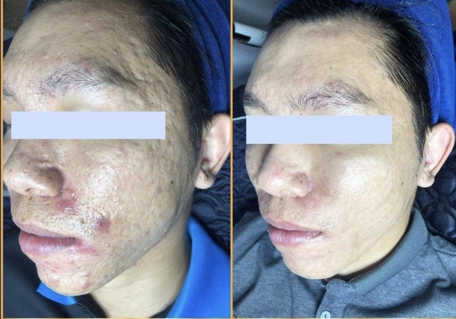 Why Skin Treatment Results Are Different for Each Person