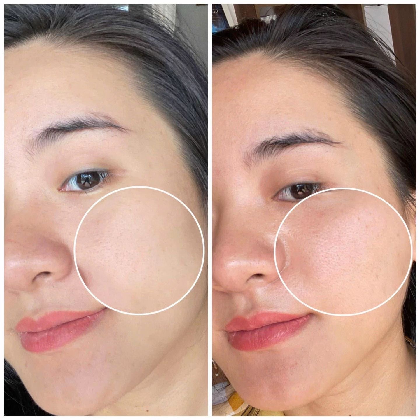 Skin Treatment image 79 at DIVA Skin Clinic Poipet